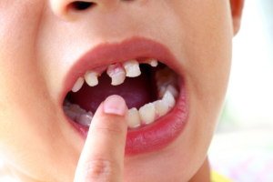 pediatric dentist near trinity