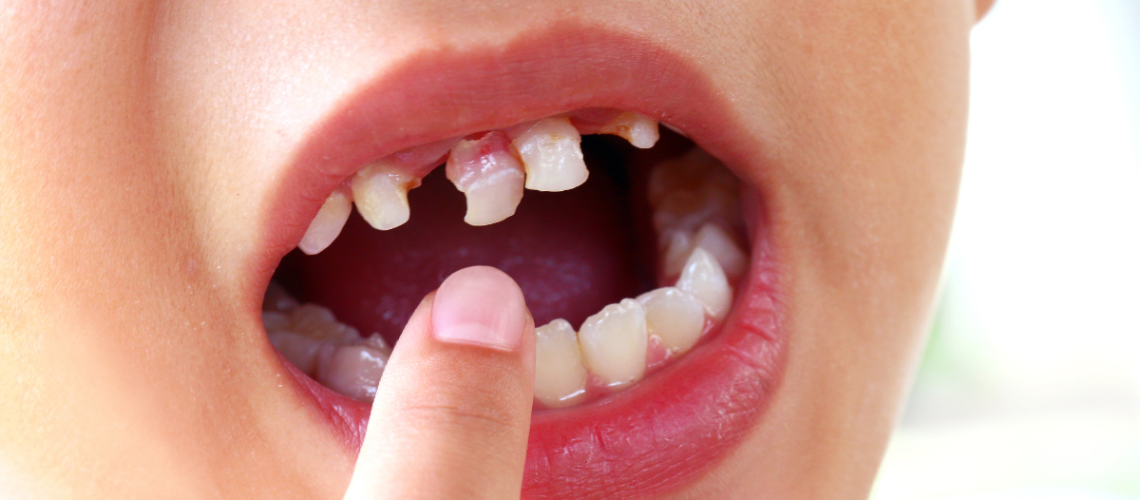 pediatric dentist near trinity